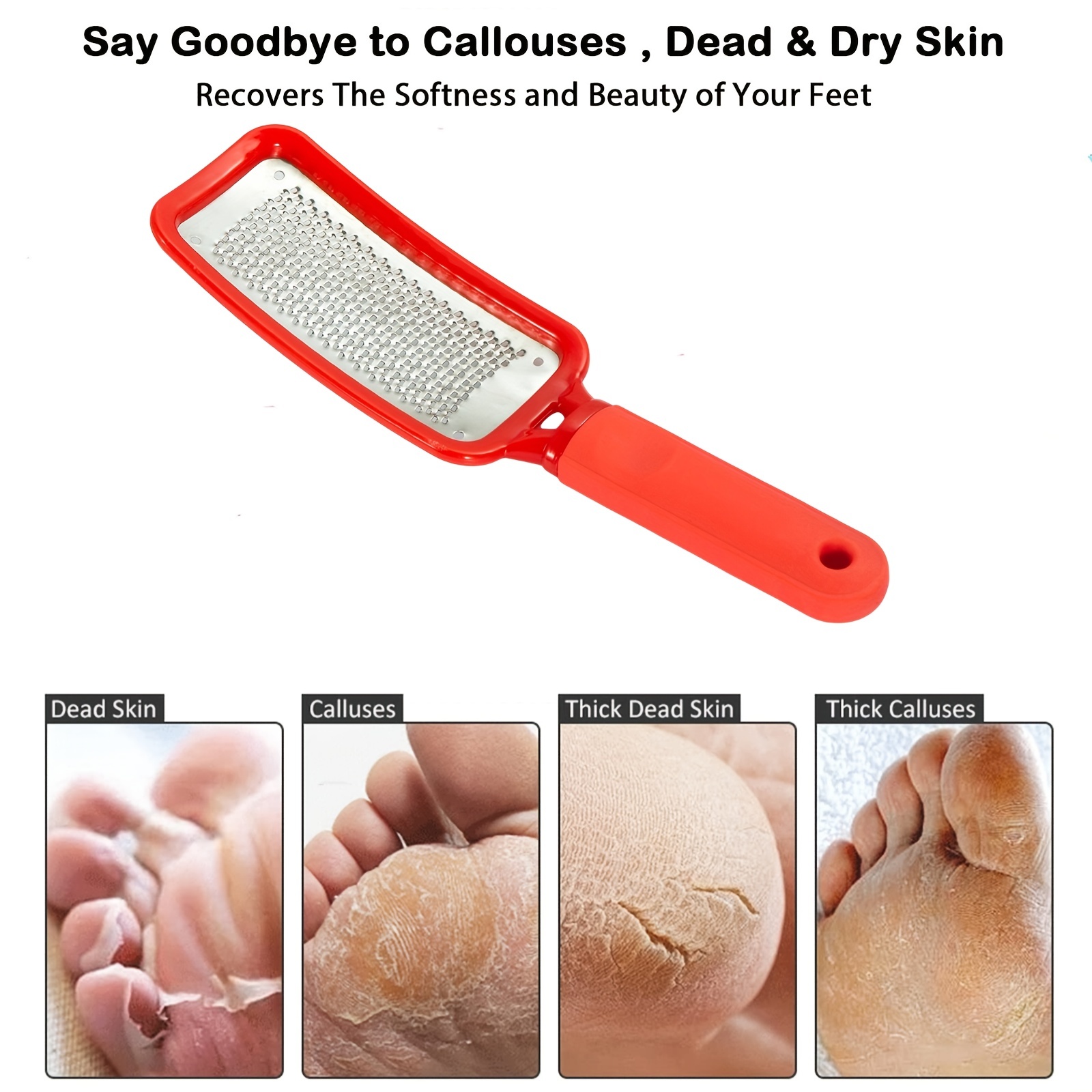 Pedicure Foot File Callus Remover -large Foot Rasp Colossal Foot Scrubber  Professional Stainless Steel Callus File For Wet And Dry Feet
