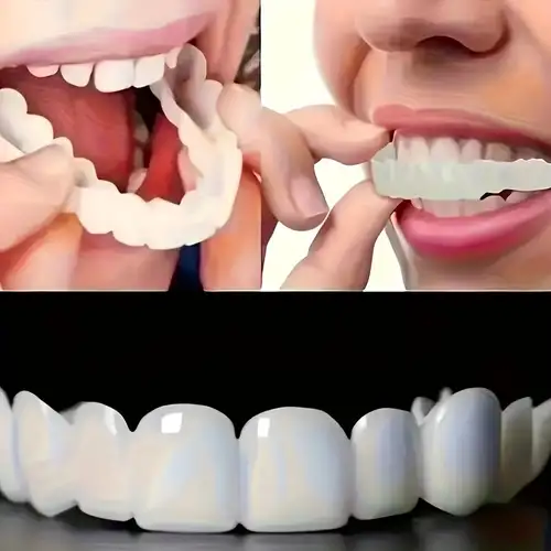 2pcs/set Silicone Blanchiment Des Dents Attelles, Couverture De Dents  Supérieure Inférieure, Dentier De Simulation, Livraison Gratuite, Retours  Gratuits