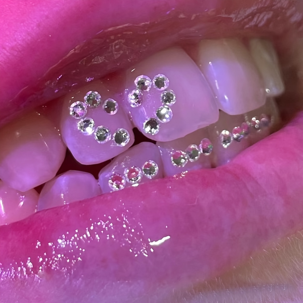 1 Caja De Gemas Dentales De Mariposa Y2k En Rosa, Moda de Mujer
