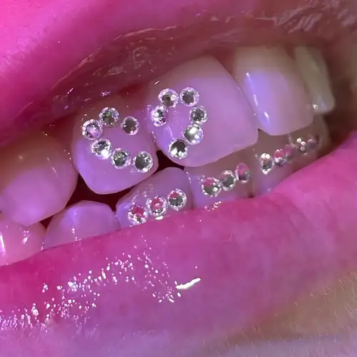 Brillantini ai denti estate 2022: le tooth gems, idee in foto
