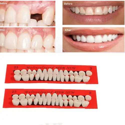Crea un sorriso perfetto con 28 denti finti dentali per protesi dentali in  resina acrilica completa - Materiali dentali A2 in 23 tonalità per fai da t