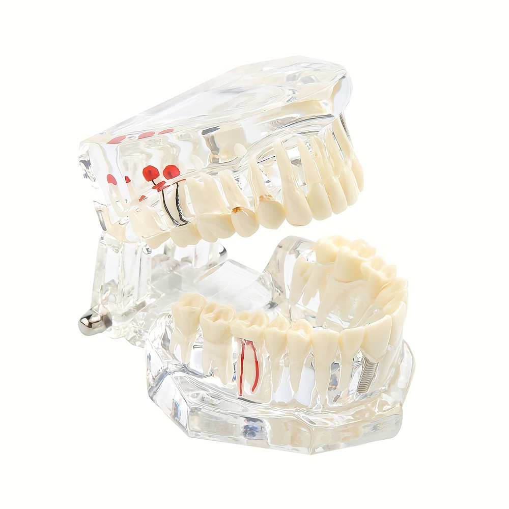 Modèle Dentaire Pédagogique Modèle de brossage des dents, modèle  d'enseignement de dentiste, modèle de dents d'enseignement dentaire 2X  modèle de