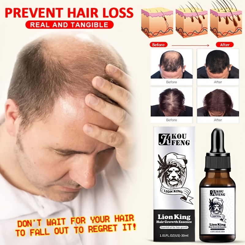 30ml Hair Growth Essential Oil Fast Growing Products Beauty Hair Care  Prevent Hair Loss Scalp Treatment For Men Women Products | Don't Miss These  Great Deals | Temu