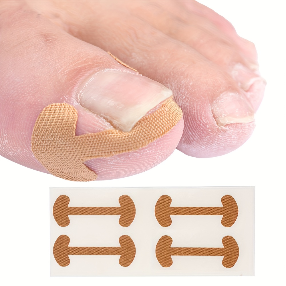 8pcs Ingrown Toenail Foot Corrector Stickers Toe Nail Care Pedicure Tools