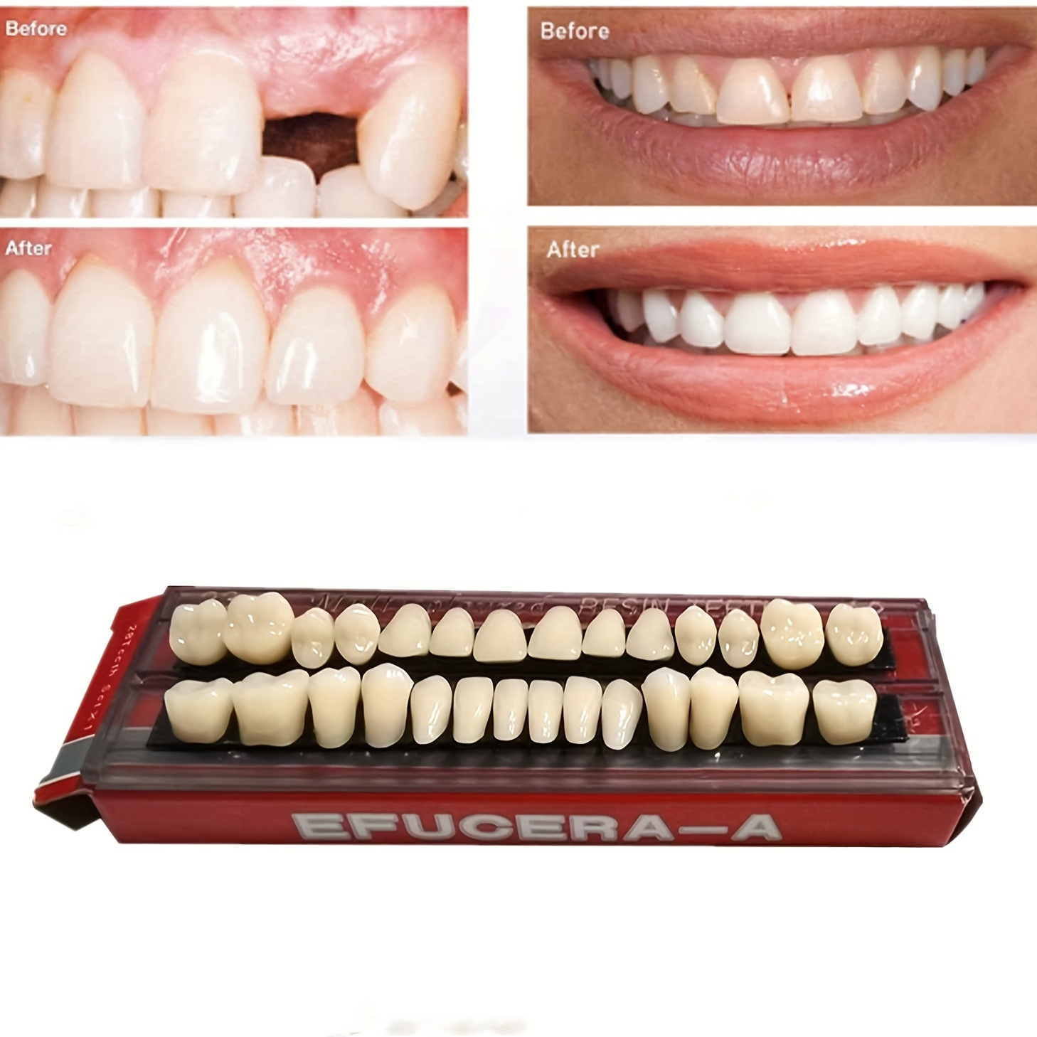 Dental Synthetic Resin Tooth Denture False Teeth For - Temu