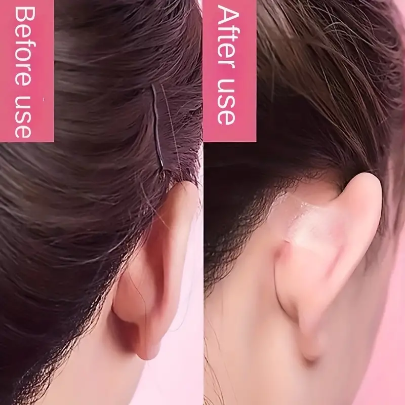 30pcs Elf Ear Stickers Veneer Ears Convierten En Corrección - Temu