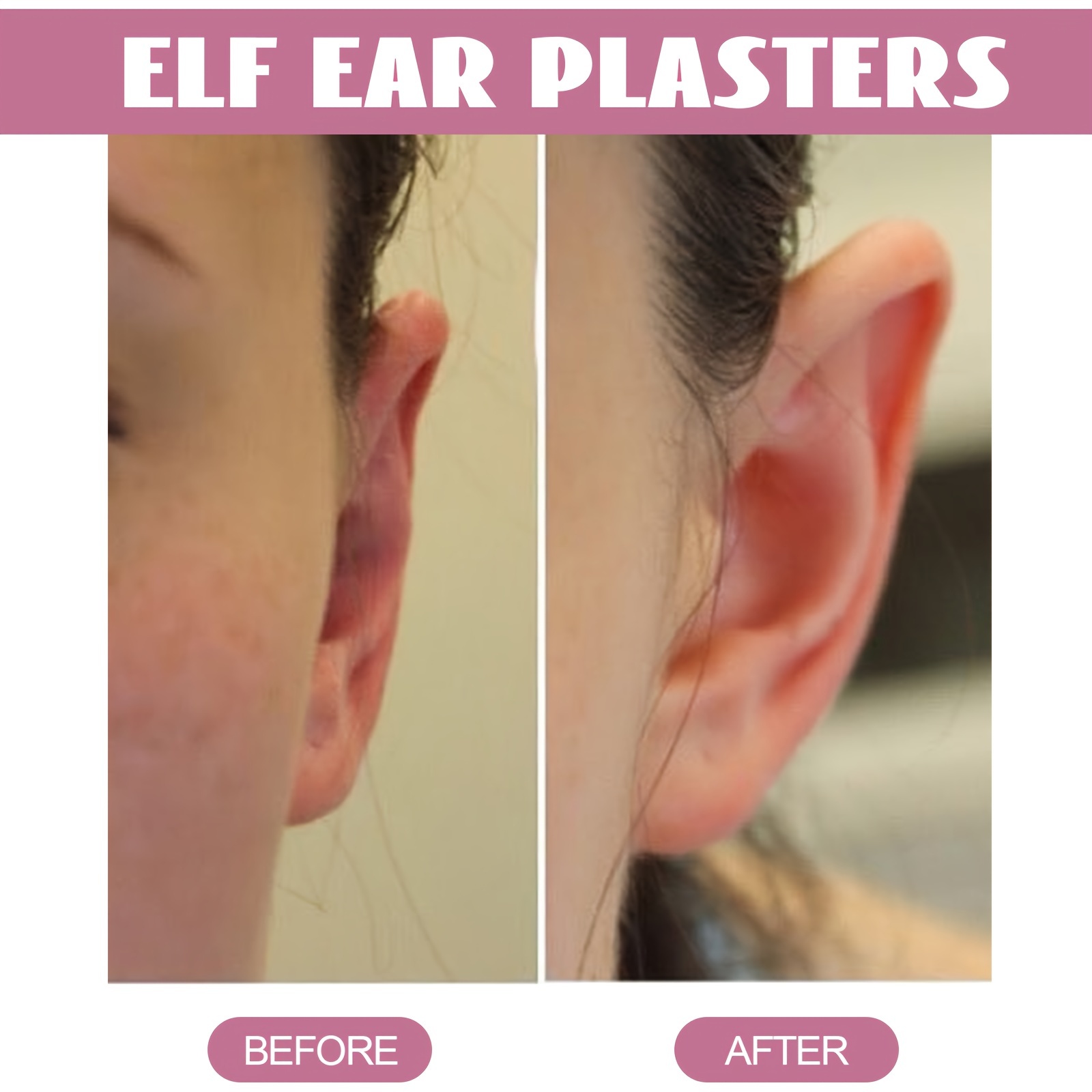 Pegatinas de oreja de elfo para cara más pequeña, Clips invisibles para  oreja, parches de corrección de oreja de pie, herramienta de maquillaje de  silicona, Parche de cara en V reutilizable 