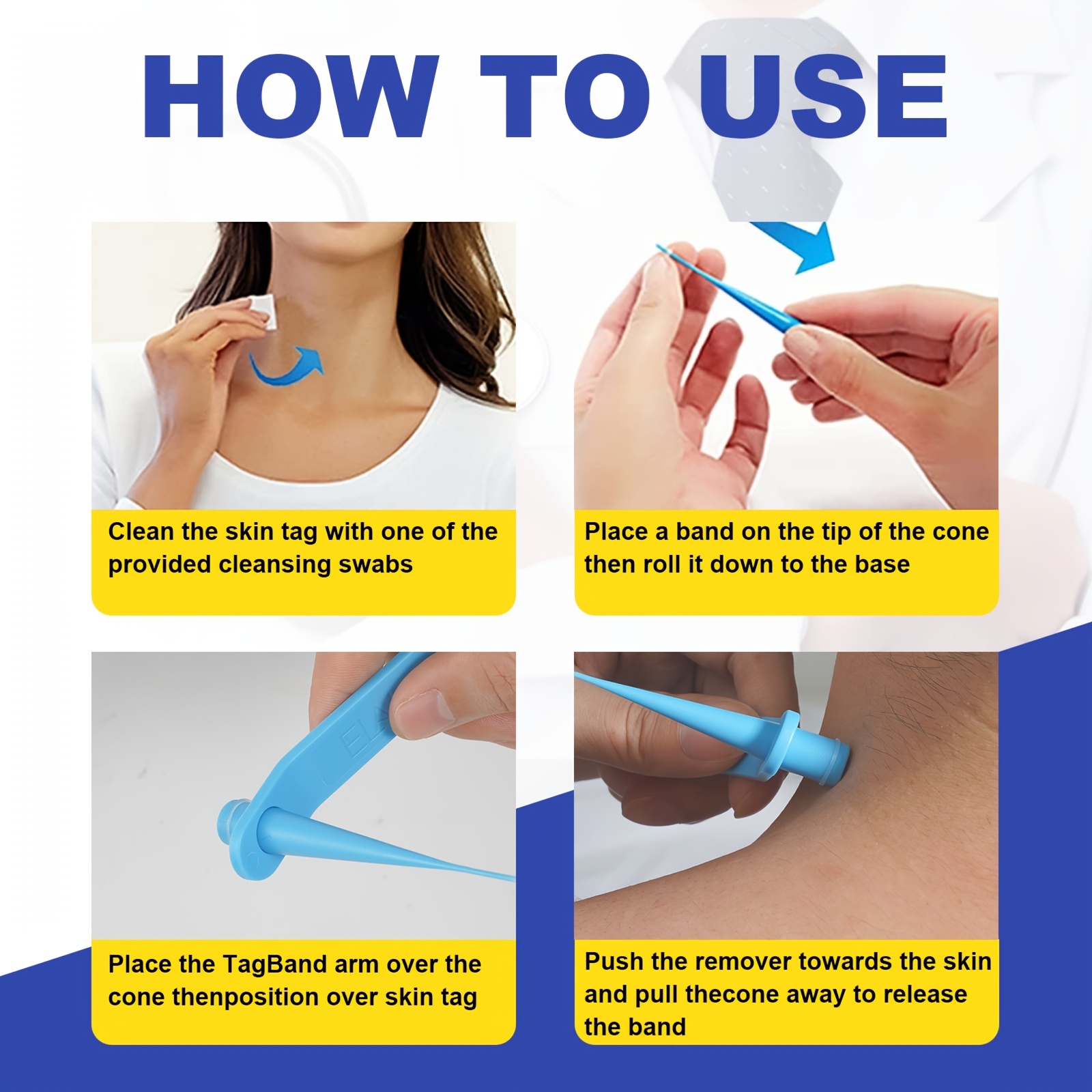 Skin Tag Wart Remover Device Freeze Away Remove Fast Effective