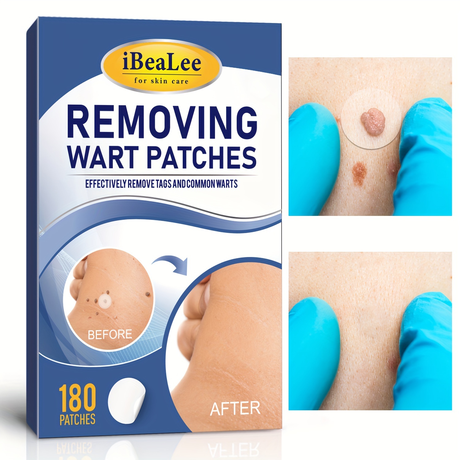 Skin Tag Patches For Covering Mole Wart Skin Tag Patches - Temu