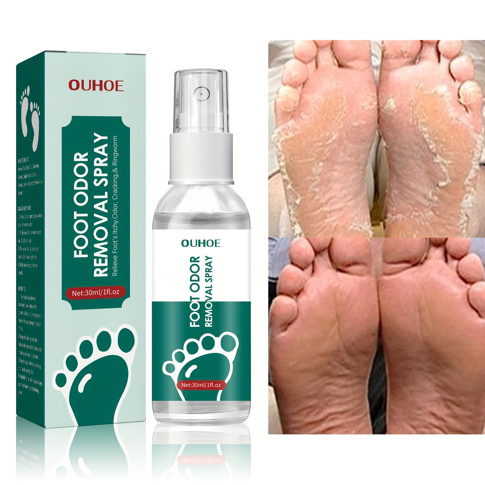 Callus Dead Skin Removal Spray Foot Heel Cracked Repair Exfoliating &  Moisturizing for Dryness Hand Feet Care 60ml