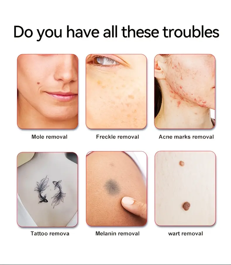 lescolton skin dark spot remover mole tattoo removal plasma pen machine facial freckles label warts removal beauty care details 2