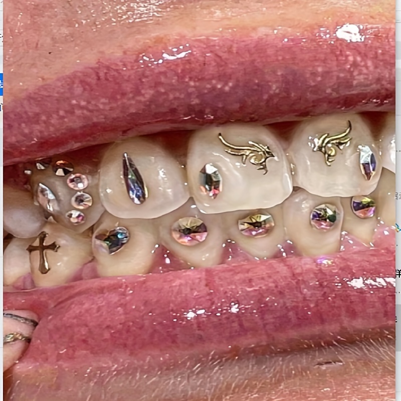 Rhinestone Teeth Gem Kit Hip Hop Style Super Shiny Teeth - Temu