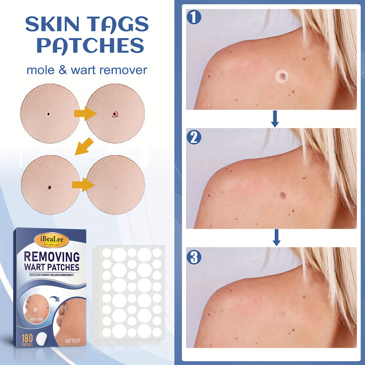 Ibealee Tag And Wart Remover, Skin Tag Removal Natural Skin