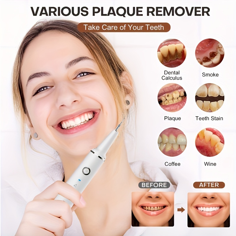 Ultrasonic Teeth Cleaner Kit - 3 Modes, Rechargeable, LED Light, Fast Charge, 4  Heads - Get a Professional Cleaning at Home!