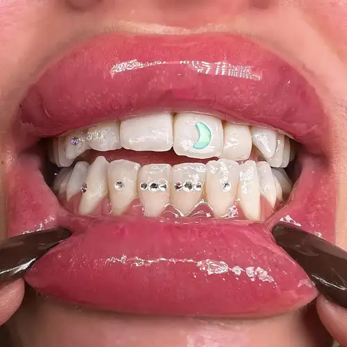 Adjustment Glue For Tooth Gems Self adhesive Tooth - Temu