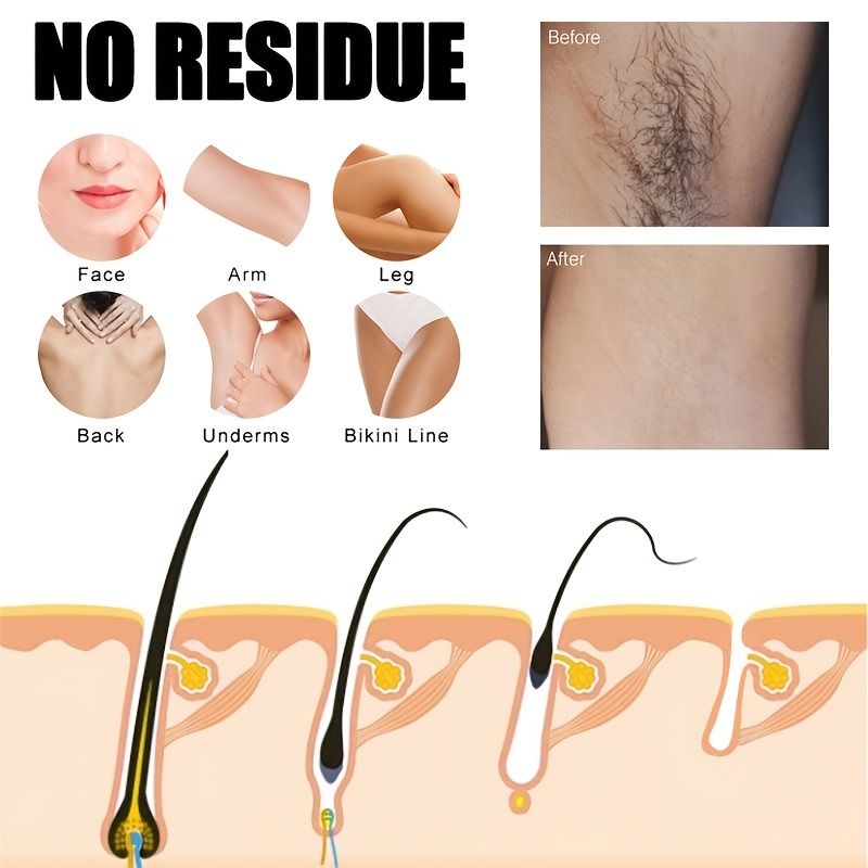Body Wax Strips Hair Remover Waxing Strip Kit Mild Portable And Fast For  Leg Hair Armpit Hair Lip Hair Removal Clean Tear Off Type Hair Removal  Sticker | Free Shipping For New