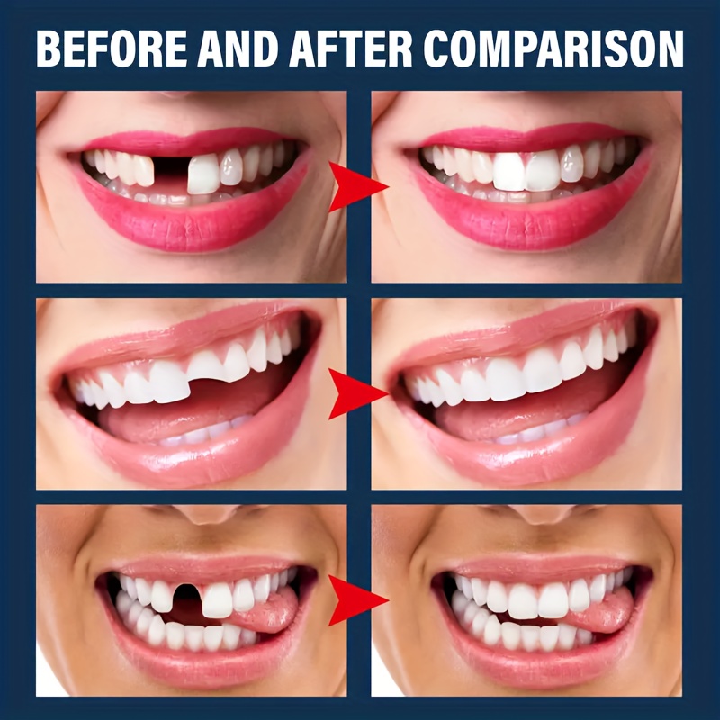 1 pza., Pegamento firme para dientes postizos, juego de reparación temporal  de dientes, dientes y espacios, dientes postizos, adhesivo dental con pega