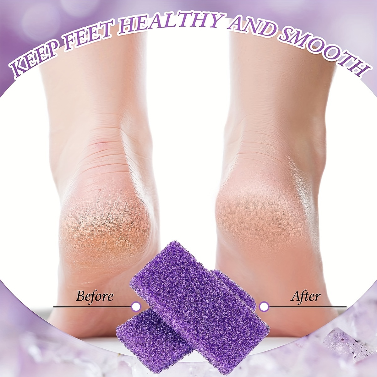 Foot Pumice Stone Callus Remover & Foot Scrubber - Smooth Feet In Seconds  Pedicure Exfoliator Tool Foot Care Tool - Temu