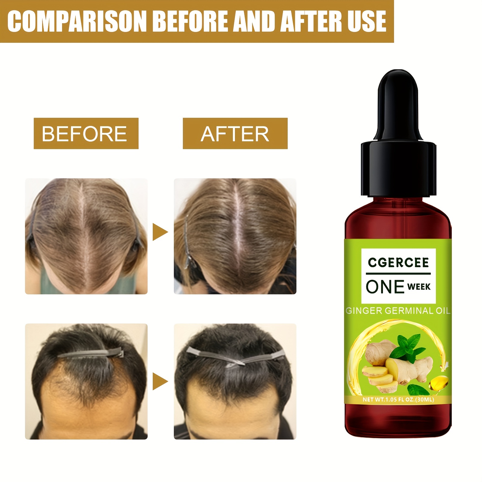 Ginger Hair Care Serum For All Hair Types