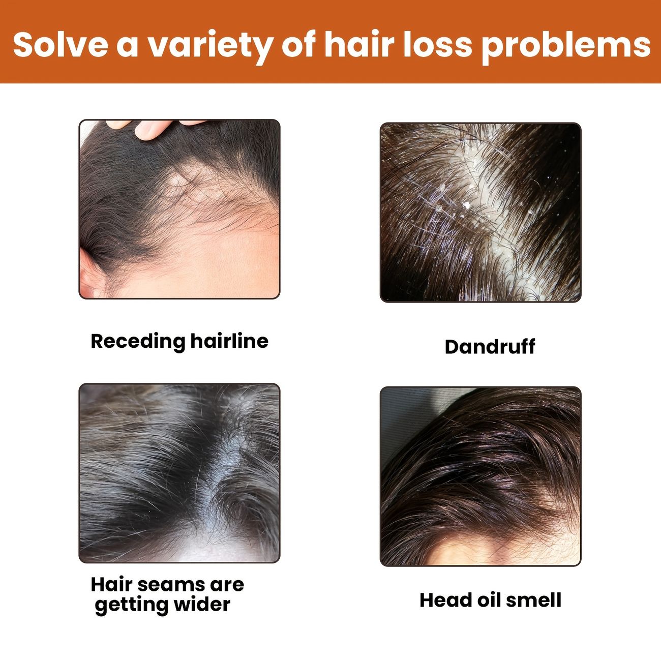 1 Bottle Of Anti Hair Loss Shampoo Nourishing And Softening Anti Hair Loss Growth Deep Cleansing Anti Itch Foam Shampoo - Beauty & Personal Care - Temu Canada 1 Bottle Of Anti Hair Loss Shampoo Nourishing And Softening Anti Hair Loss Growth Deep Cleansing Anti Itch Foam Shampoo - Beauty & Personal Care - Temu Canada