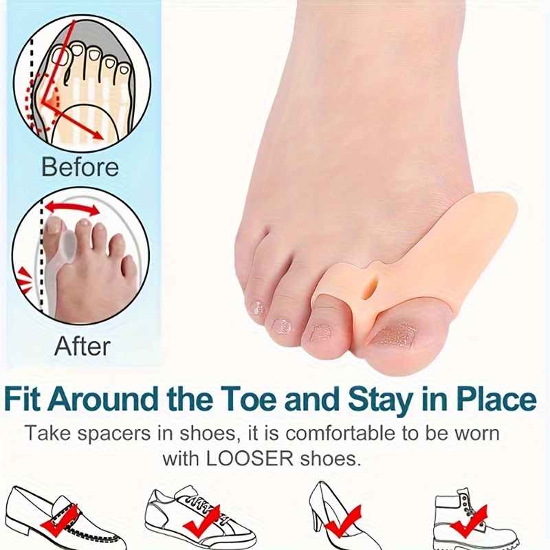 IYSHOUGONG Big Toe Hallux Valgus Corrector Silicone Feet Care SEBS Bone  Thumb Adjuster Correction Feet