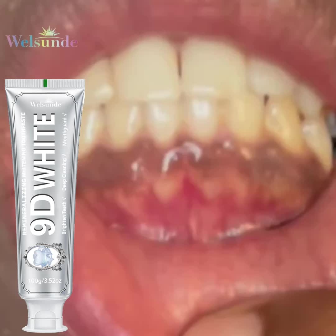 5pcs Remineralizing White Toothpaste with Hydroxyapatite