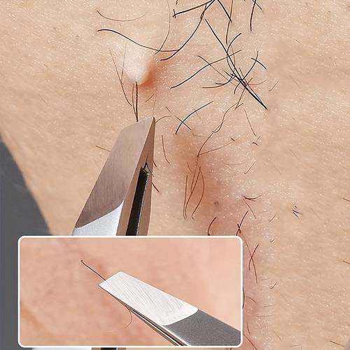 1 stainless steel eyebrow tweezers professional hair removal tweezers facial and ingrown hair removal