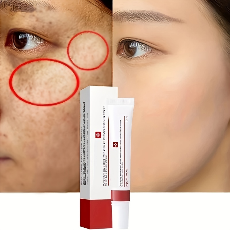 Powerful whitening freckle cream Chinese herbal plant face cream remove  freckles and dark spots 30g Skin whitening cream : : Beauty