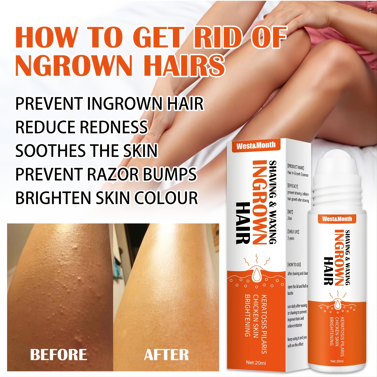The Skin Care Solution For Unsightly Bumps Ingrown Hair And Burns After  Shave Repair Serum For Ingrowns And Burns - Beauty & Personal Care - Temu