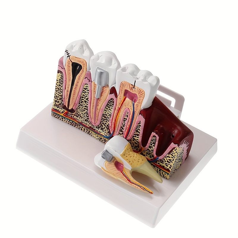 

Professional Dental Anatomy Teaching Model - Comprehensive Oral Tooth Structure For Dentists And Students