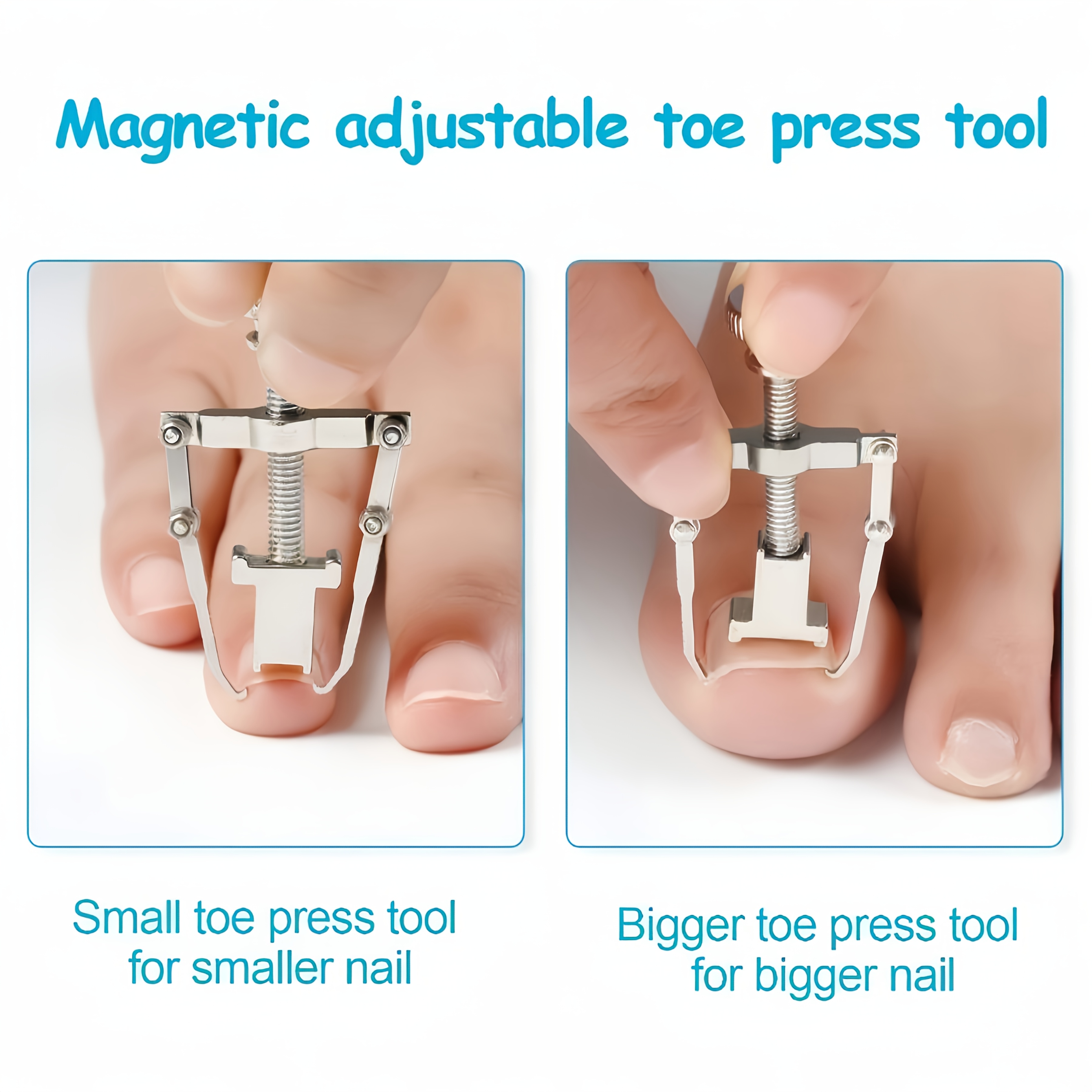 3pcs Ingrown Nail Clippers Set for Effective Care
