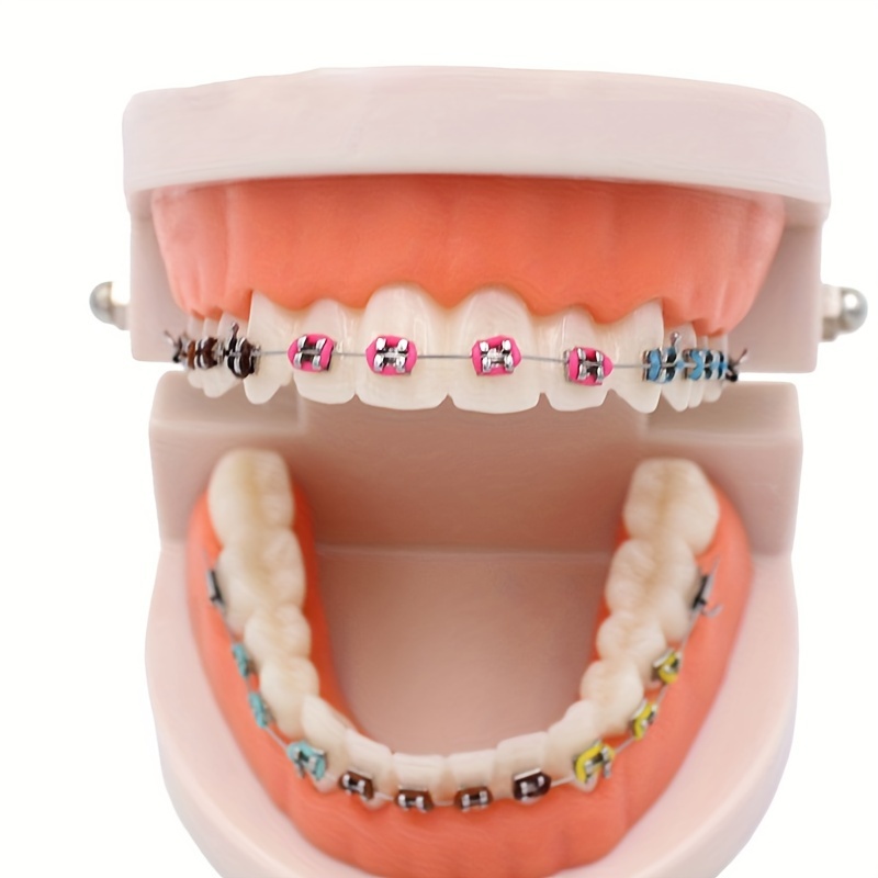 

Professional Dental Orthodontic Teaching Model With Bracket, Arch Wire & Ligature Ties - Durable Polyethylene Material