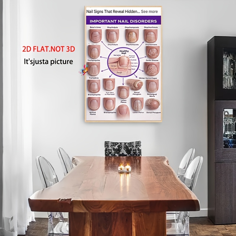 TEMU 2d Flat, 2d Flat, 1pc Frameless Nail Health Knowledge Canvas Poster, Suitable For Bedroom, Living Room, Study, Office