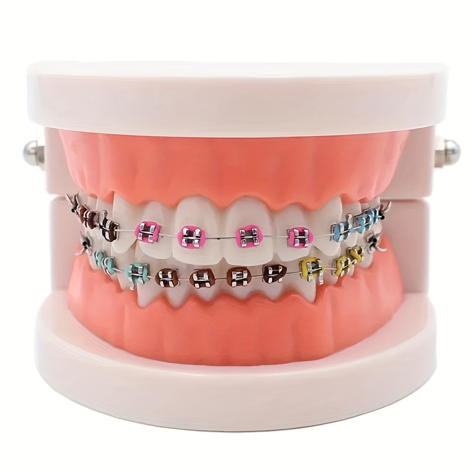 dental orthodontic demonstration model metal - Temu South Africa