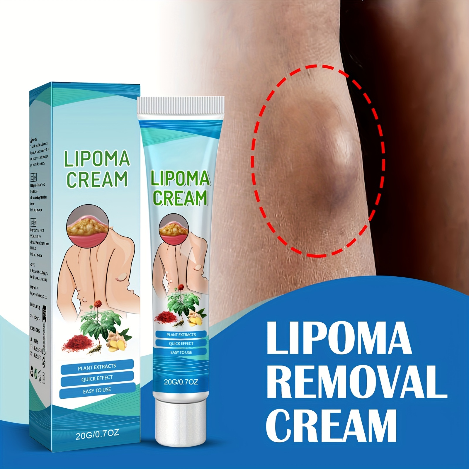 20g Lipoma Cream, Contains Ginger And Castor Oil, Body Care Cream For Moisturizing And Nourishing Skin Lip Balm Bulk Moisturizer Face Cream details 1