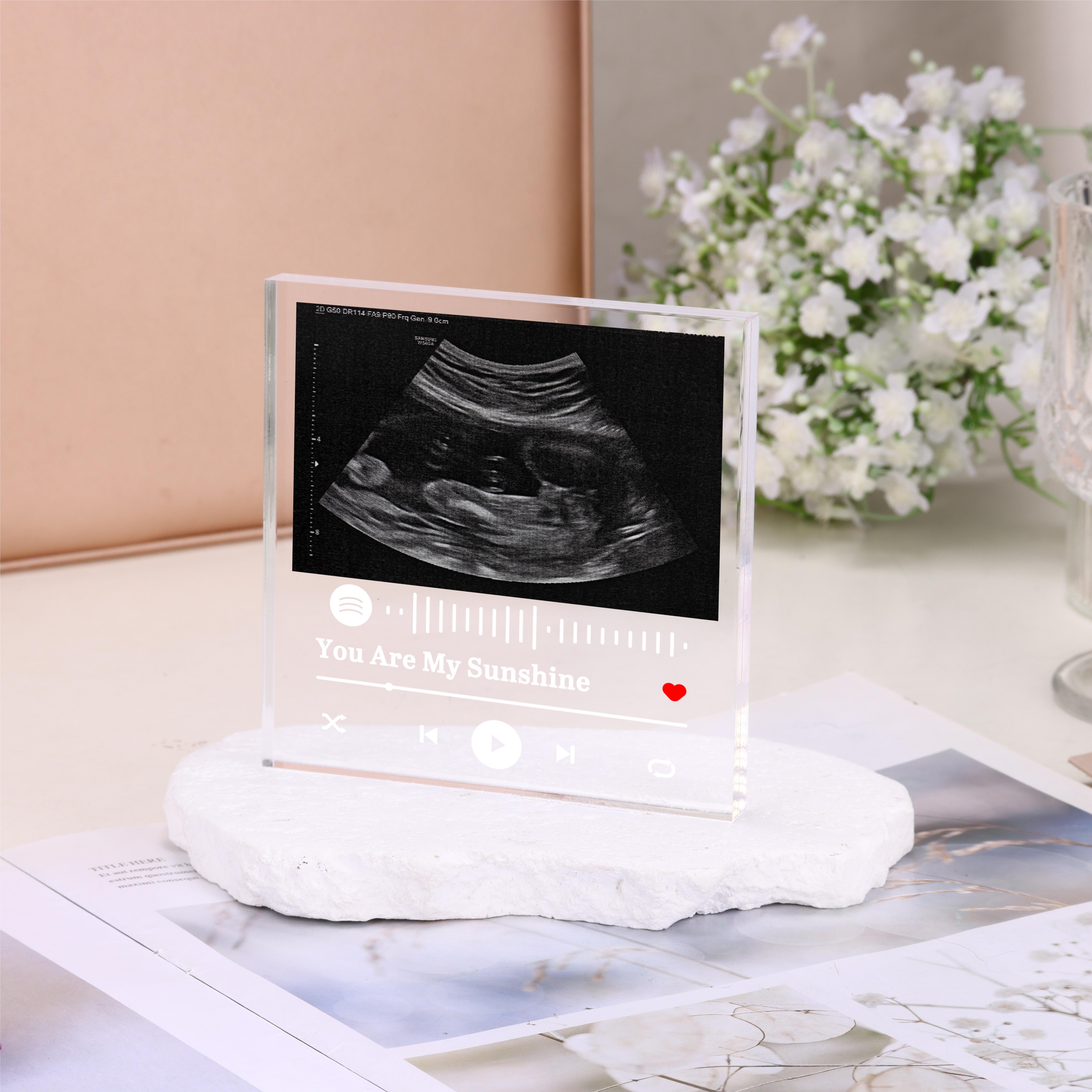Baby Scan Photo Frame - Pregnancy Announcement - Personalised
