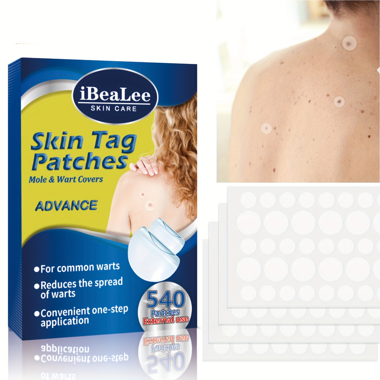 

144pcs, Skin Tag Patches With Safe Ingredients, Hydrocolloid Acne Pimple Patch For Covering Zits And Blemishes, Spot Stickers For Face And Skin, Mild And Non-irritating