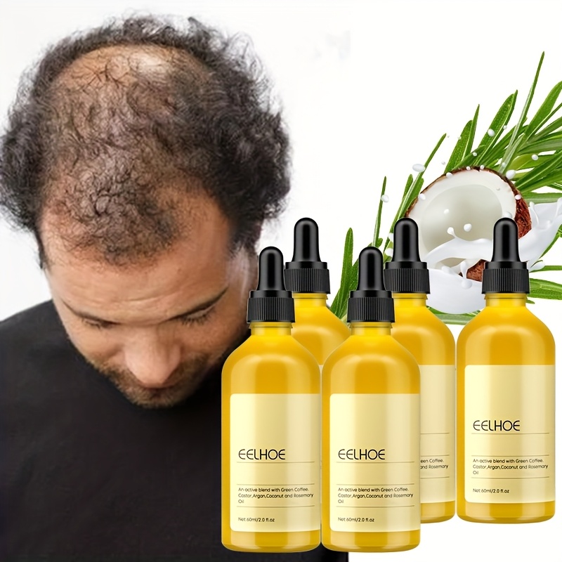 TEMU 5pcs Hair Care Oil, Natural Hair Density Essential Oil, Plant Extract Hair Oil For Dry Damaged Hair Care, 2.03oz/pcs, Castor Hair Care Essential