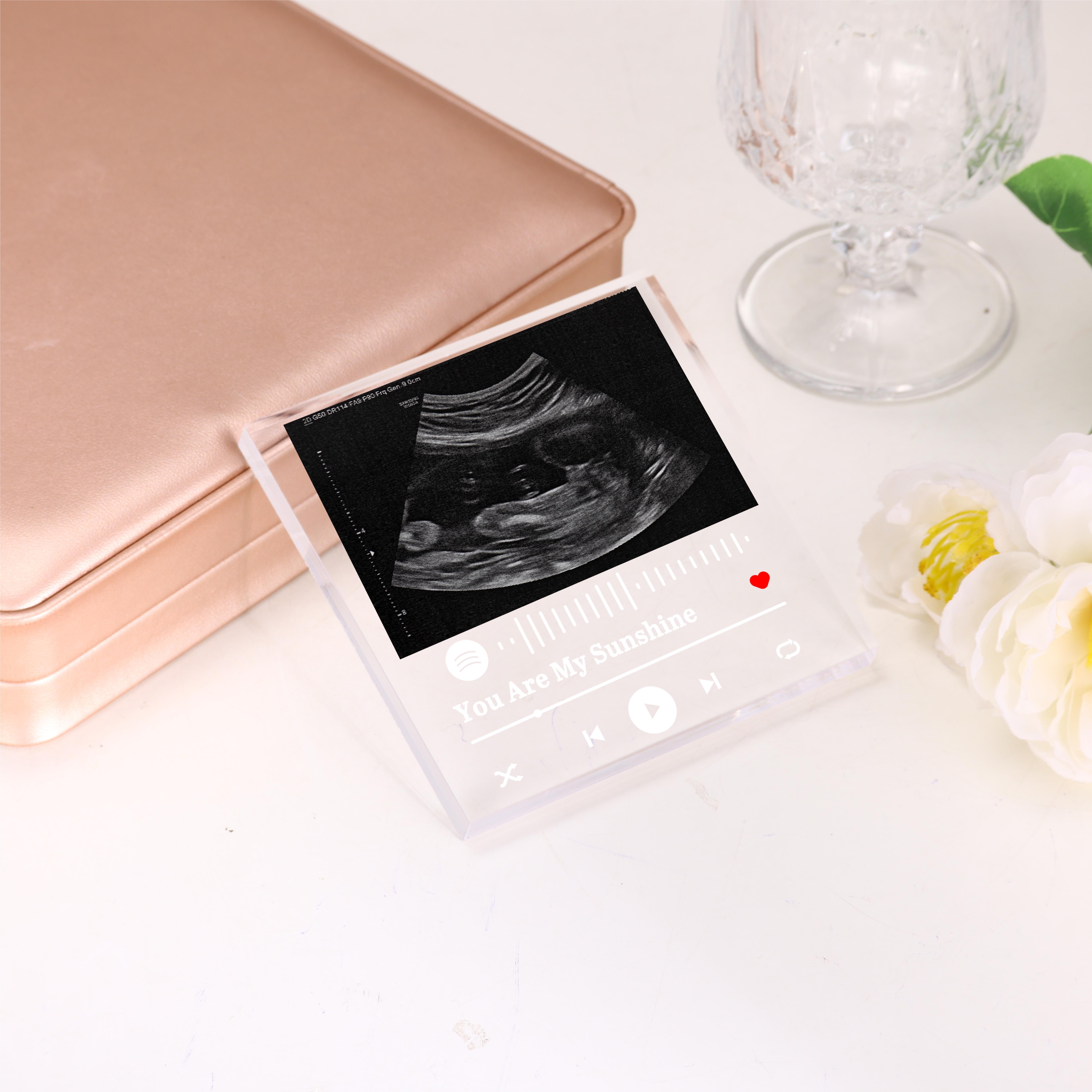 Baby Scan Photo Frame - Pregnancy Announcement - Personalised
