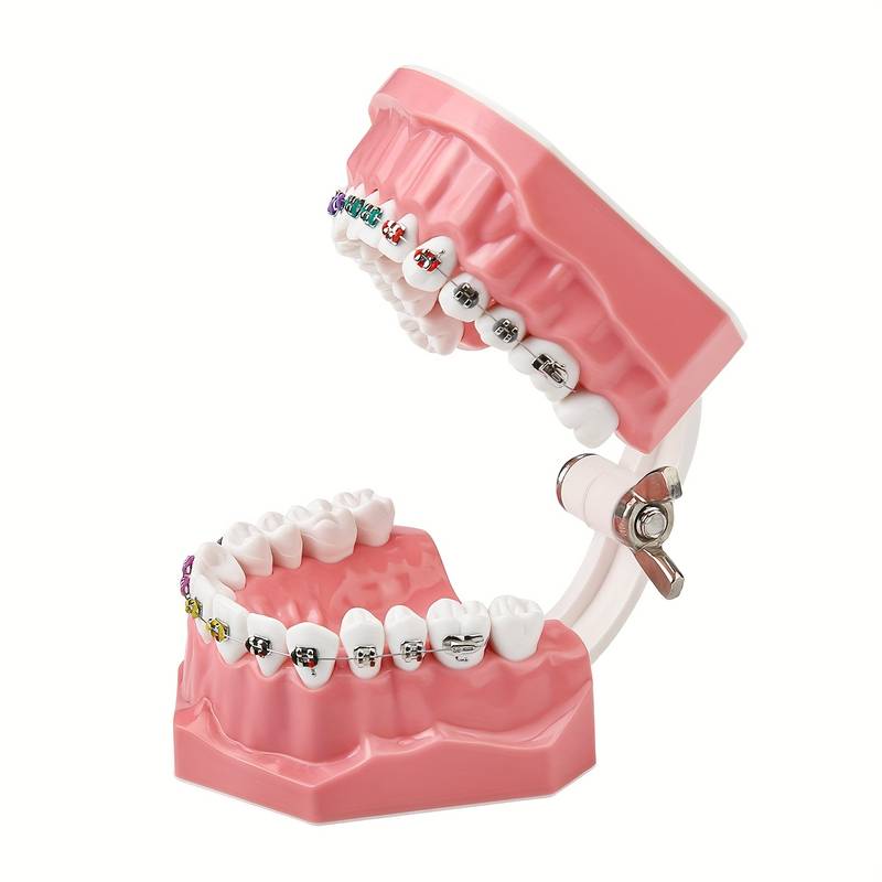1:1 Typodont Teeth Model With Metal Brackets – Orthodontic Dental Study Model M7010-2