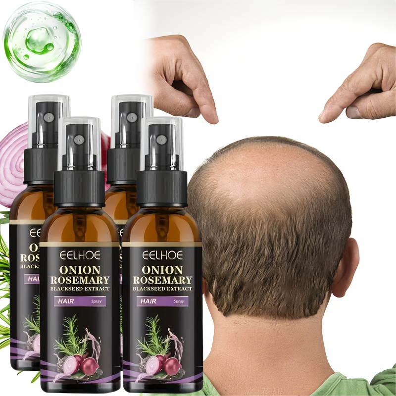TEMU 4pcs Rosemary & Onion Hair Serum, Rosemary Nourishing Scalp Massage Oil, Biotin Hair Care Serum, Hair Care Essential Spray, Make Thin Thicker,