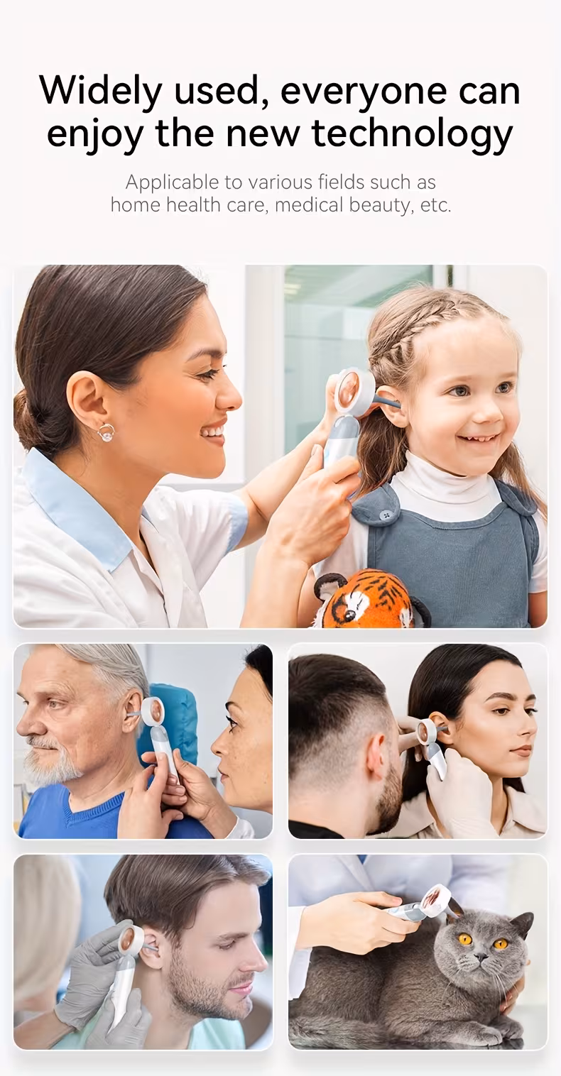 otoscope ear camera with 1 38 screen 1080p ear scope with 12 silicone tips support photo and view ideal pocket otoscope for home use and pets Product details 6