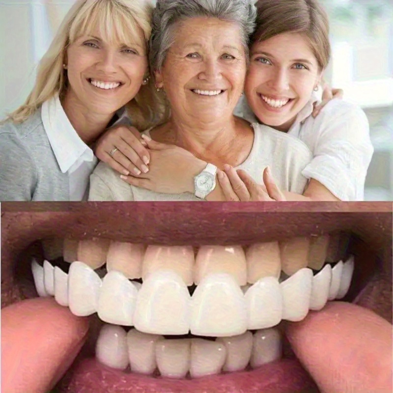 Juego de 2 piezas de s dentales cosméticas temporales ajustables para dientes superiores e inferiores, estuche, diseño de , , para hombres y mujeres, para aumentar en 0