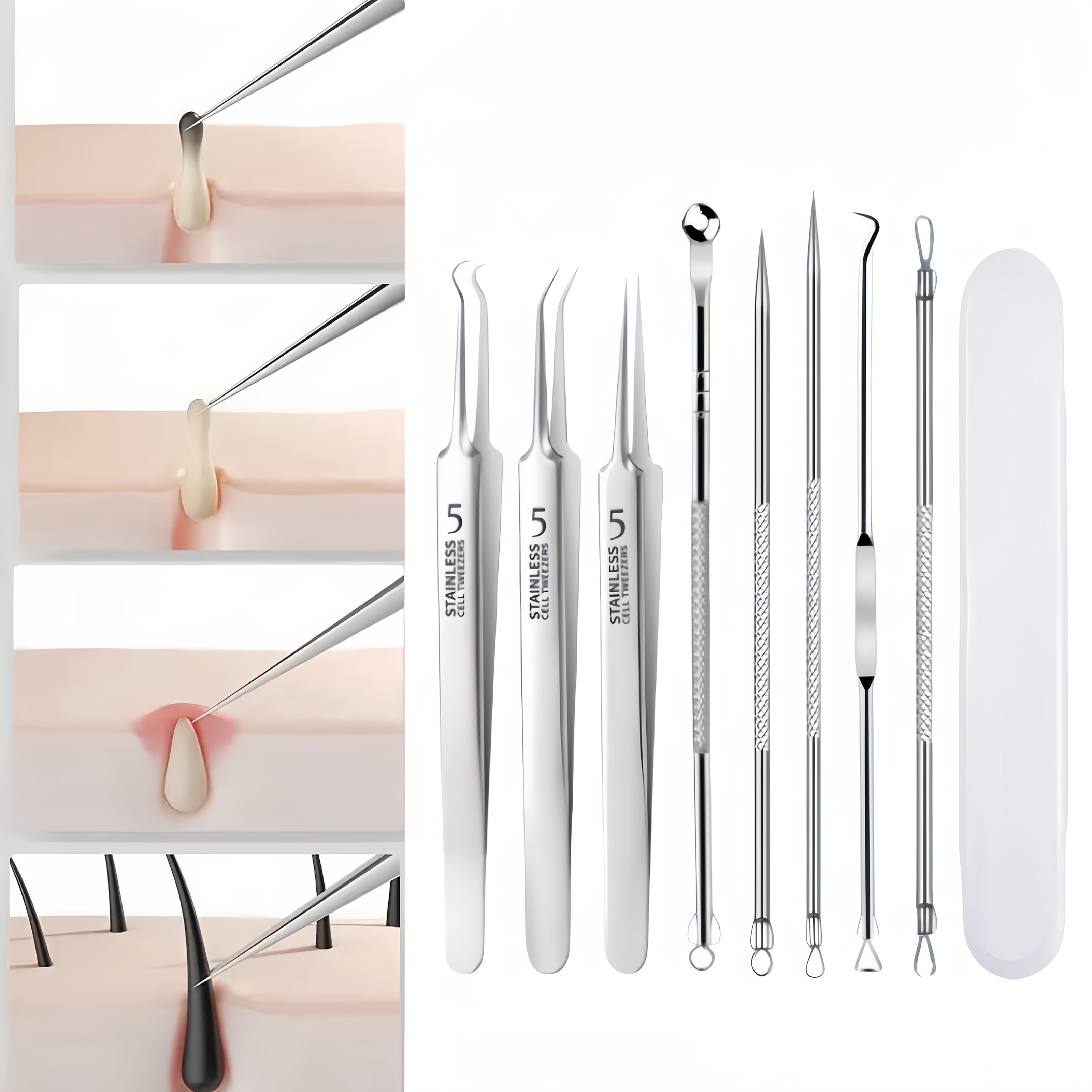 

Steel & Removal Set - Hypoallergenic, Types - Includes , Pimple , And