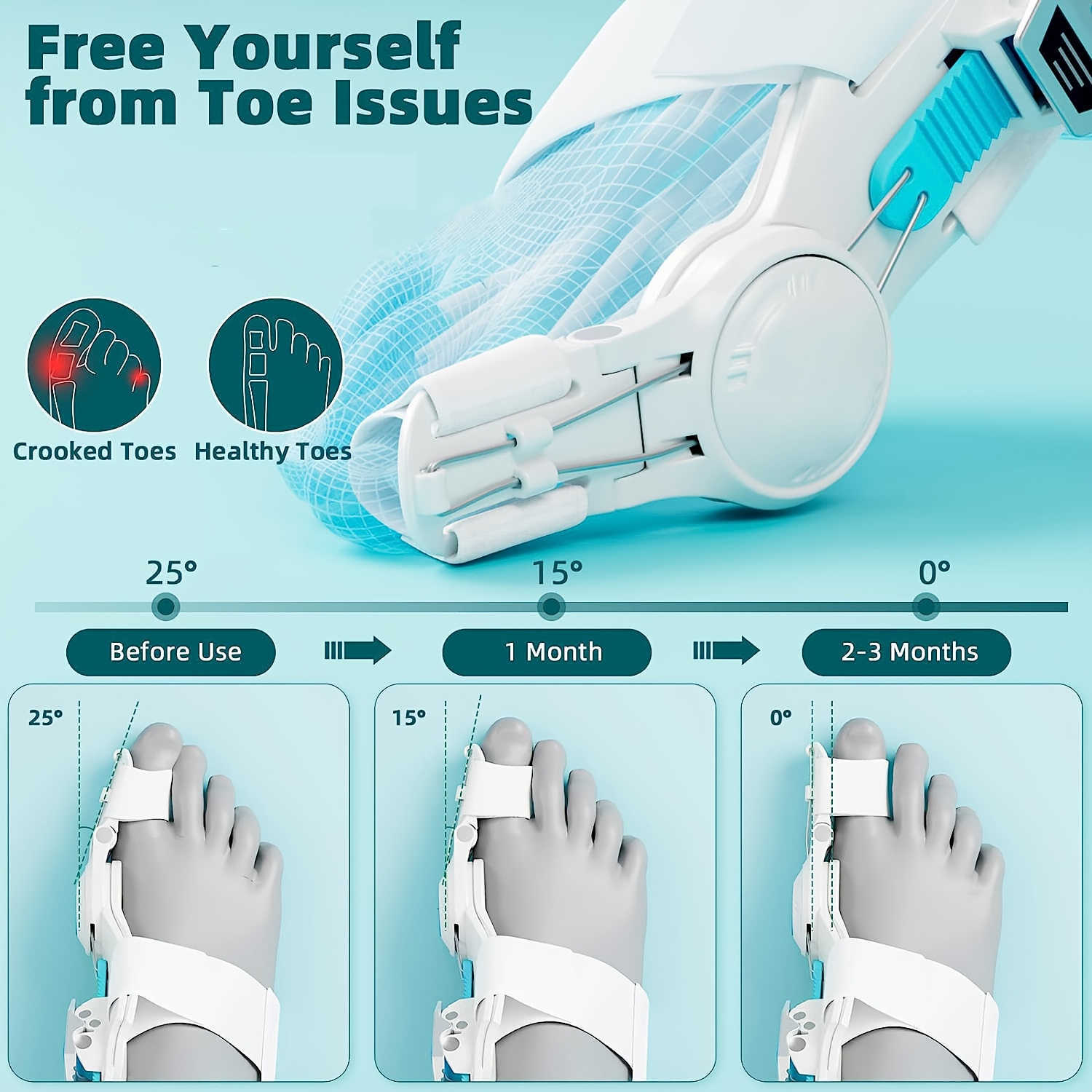 Upgraded Bunion Corrector for Women & Men, Orthopedic Bunions Correction, Adjustable Bunion Splint Suitable for Left/Right Feet Foot Comfort Support