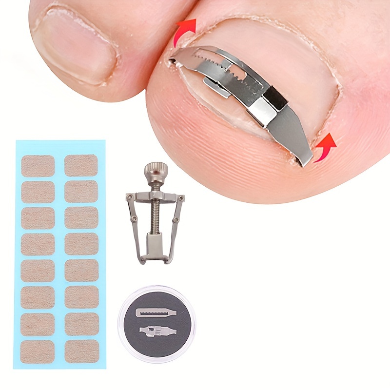 

Ingrown Toenail Tool Set Ingrown Toenail Patches Ingrown Toenail Tool Pedicure For Healthy Toe Nails