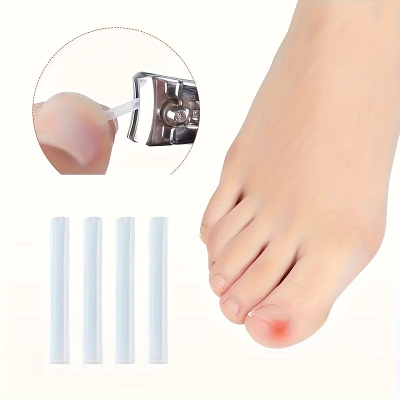 10/20/60pcs Unscented Ingrown Toenail Strips, Brace Ingrown Toenail, Pedicure Tool, Toenail Patch for Ingrown Toenail