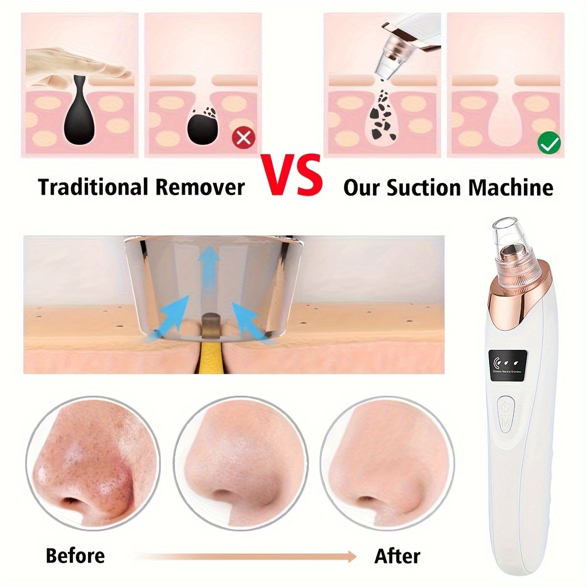 Rechargeable Handheld Facial Extractor Vacuum Device Nasal