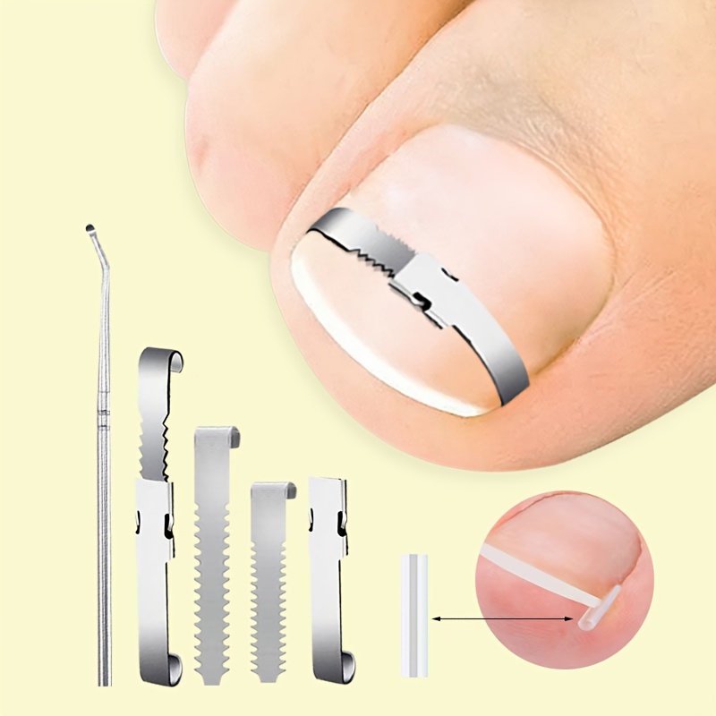 

4-piece Ingrown Toenail Correction Kit - Adjustable Nail Brace & Lifter, Foot Care Tools For