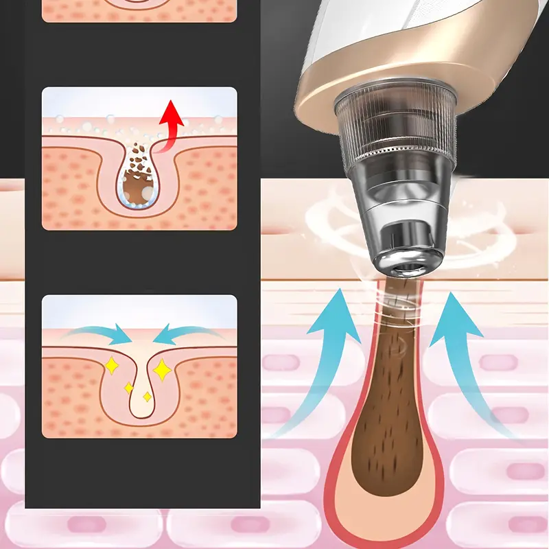dispositivo eléctrico de succión para puntos negros, limpiador facial portátil en color beige  , purificador de poros, carga usb   36v Detalles del producto 1